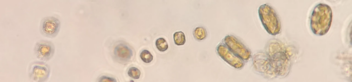 Magnified diatoms and phytoplankton in Hood Canal seawater